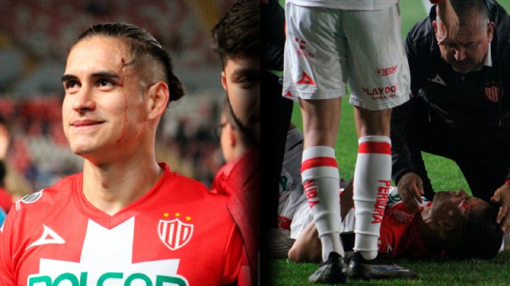 ¡Lamentable! Alexis Peña es HERIDO en la cabeza por aficionados del Atlas