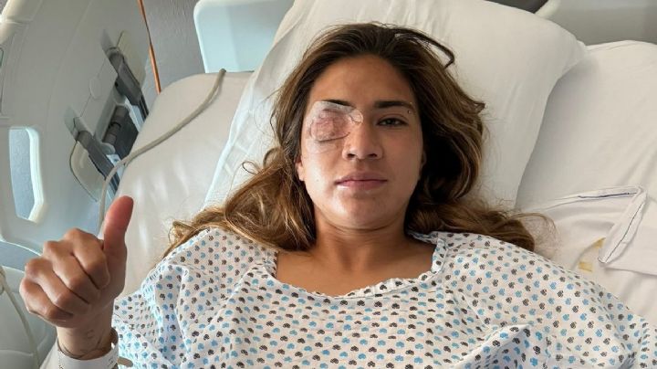 Nayeli Rangel muestra CÓMO QUEDÓ su rostro desde el hospital