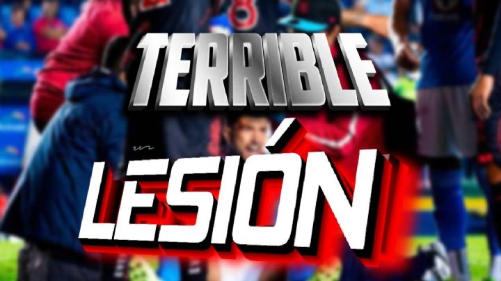 Así fue la FUERTE LESIÓN en la cabeza que NO FUE FALTA a Nacho Rivero en el Cruz Azul vs Xolos